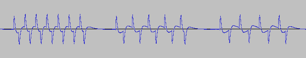 an audio waveform